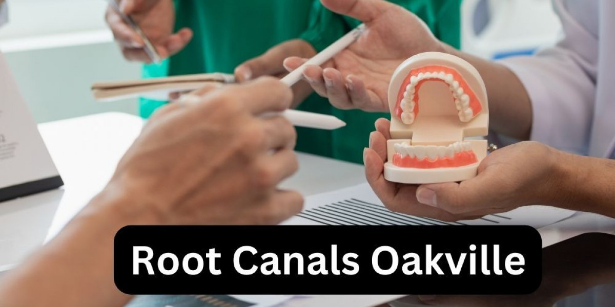 Root Canals Oakville: A Comprehensive Guide