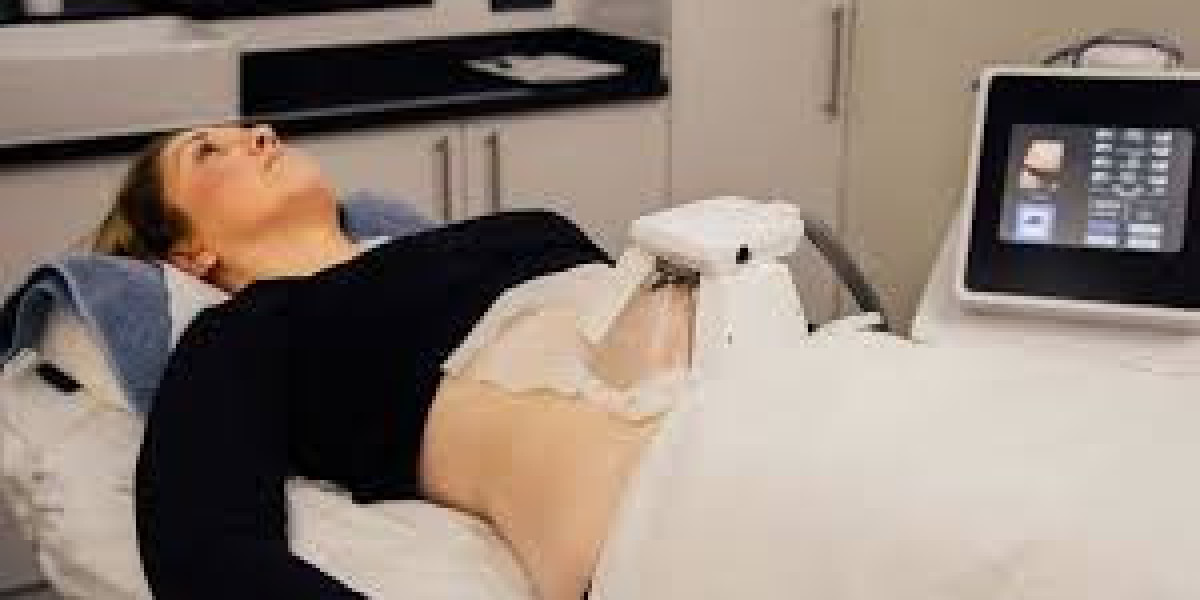 Who Should Consider FAT REMOVAL TREATMENT Islamabad? A Doctor’s Perspective
