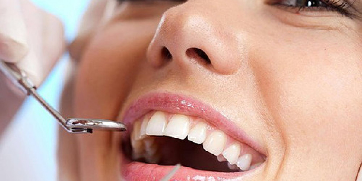 The Ultimate Guide to Permanent Dentures in Odessa